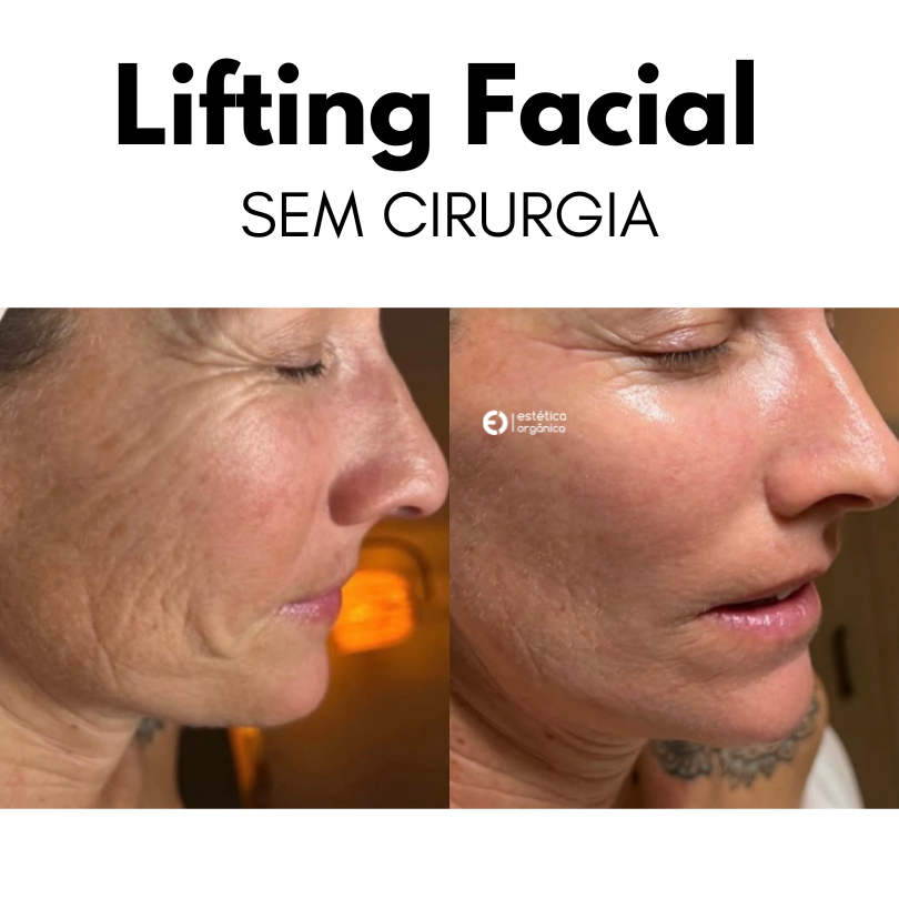 LIFIT BASICO